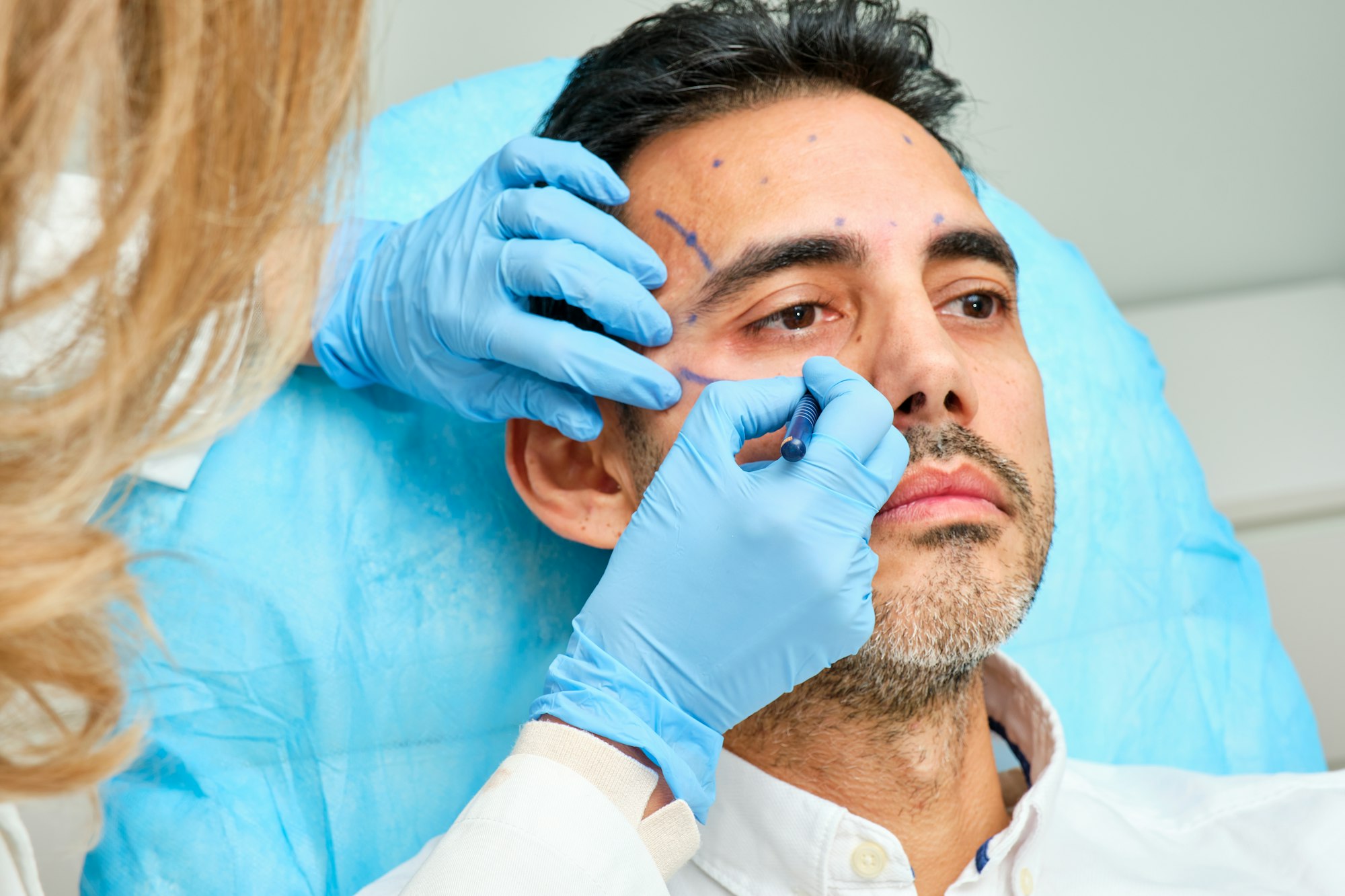 painting the face of a 45-year-old man for an aesthetic treatment with botulinum toxin